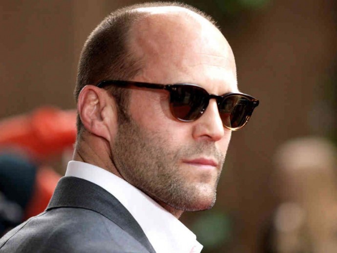 Male Pattern Baldness - What It Is & What Causes It | Male Standard